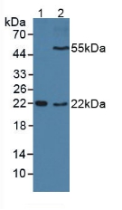 Polyclonal Antibody to Cluster Of Differentiation 209 (CD209)