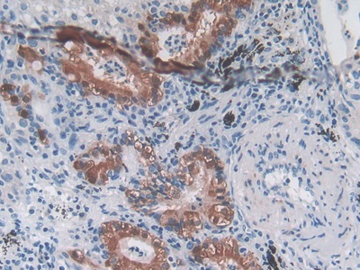 Polyclonal Antibody to Myostatin (MSTN)