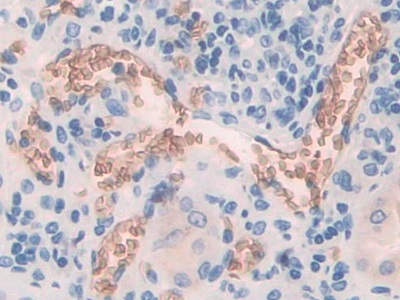 Polyclonal Antibody to Band 3 (BND3)