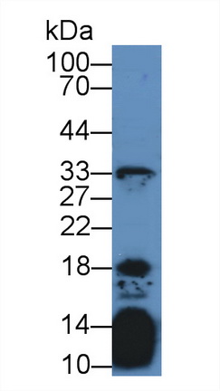 Polyclonal Antibody to Interleukin 21 (IL21)