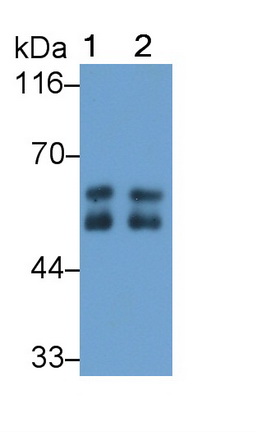 Polyclonal Antibody to Alpha-1-Antitrypsin (a1AT)