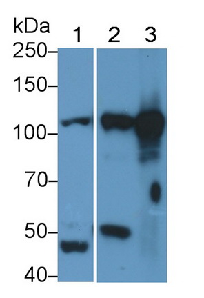 Polyclonal Antibody to Signal Transducer And Activator Of Transcription 5B (STAT5B)