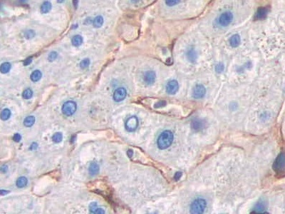 Polyclonal Antibody to Cluster Of differentiation 299 (CD299)
