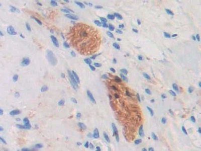 Polyclonal Antibody to Cluster Of differentiation 299 (CD299)