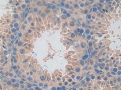 Polyclonal Antibody to Cluster Of differentiation 301 (CD301)