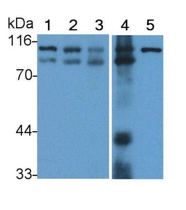 Polyclonal Antibody to Signal Transducer And Activator Of Transcription 6 (STAT6)