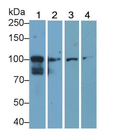 Polyclonal Antibody to Signal Transducer And Activator Of Transcription 6 (STAT6)