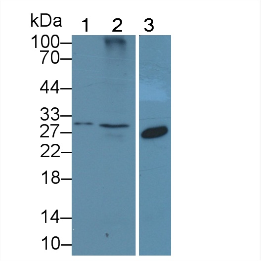 Polyclonal Antibody to Killer Cell Lectin Like Receptor Subfamily K, Member 1 (KLRK1)