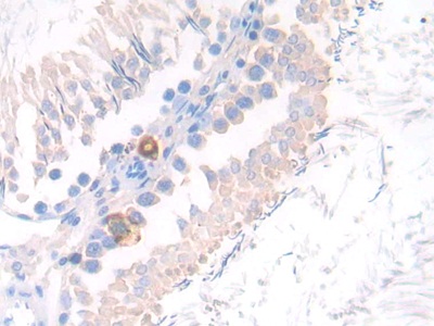 Polyclonal Antibody to Neprilysin (CD10)