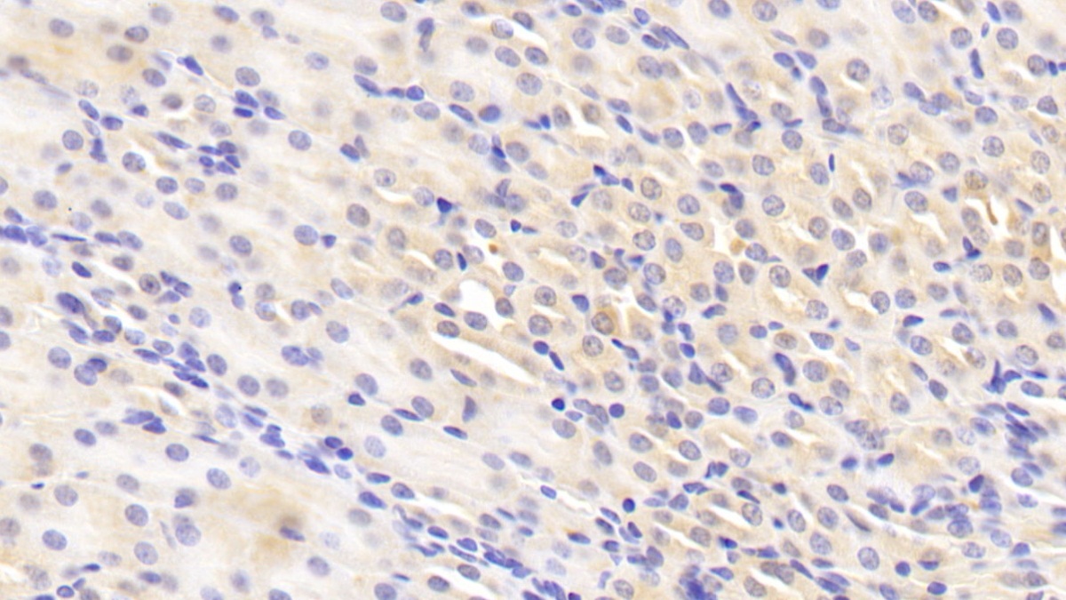 Polyclonal Antibody to Fibroblast Growth Factor Receptor 4 (FGFR4)