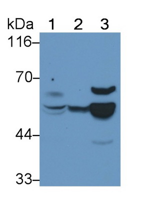 Polyclonal Antibody to Interleukin 6 Receptor (IL6R)