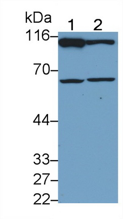 Polyclonal Antibody to Nuclear Factor Kappa B (NFkB)