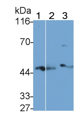 Polyclonal Antibody to Nuclear Factor Kappa B (NFkB)