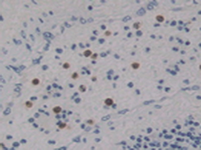 Polyclonal Antibody to Netrin 4 (Ntn4)