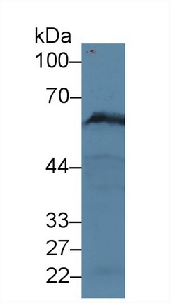 Polyclonal Antibody to Paxillin (PXN)