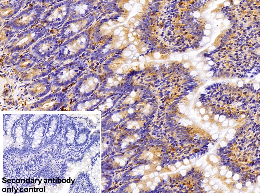 Polyclonal Antibody to Tubulin Beta (TUBb)