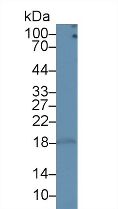 Polyclonal Antibody to Cluster Of Differentiation 3d (CD3d)