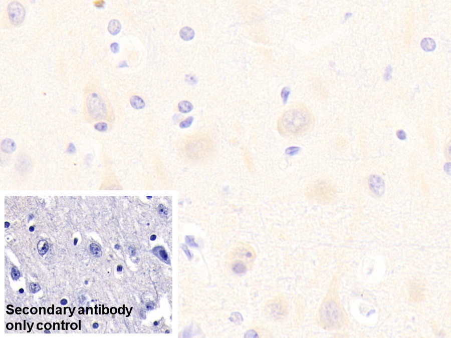 Polyclonal Antibody to Metabotropic Glutamate Receptor 3 (GRM3)