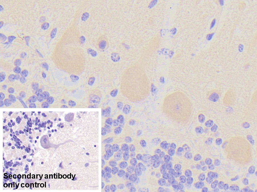 Polyclonal Antibody to Metabotropic Glutamate Receptor 3 (GRM3)