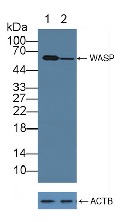 Polyclonal Antibody to Wiskott Aldrich Syndrome Protein (WASP)