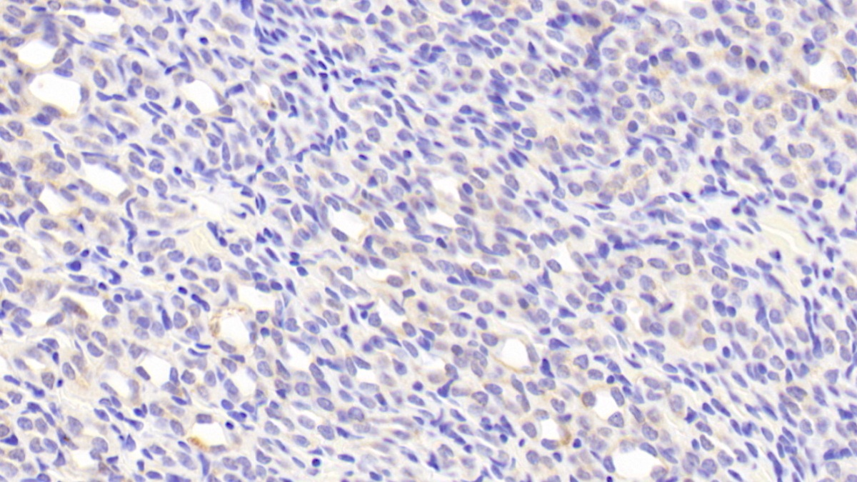 Polyclonal Antibody to Pigment Epithelium Derived Factor (PEDF)