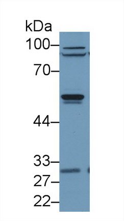Polyclonal Antibody to Arrestin Beta 2 (ARRb2)