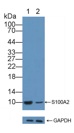 Polyclonal Antibody to S100 Calcium Binding Protein A2 (S100A2)