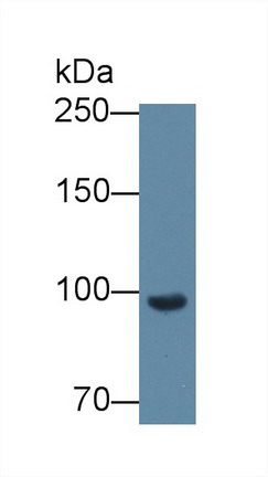 Polyclonal Antibody to Complement Factor B (CFB)