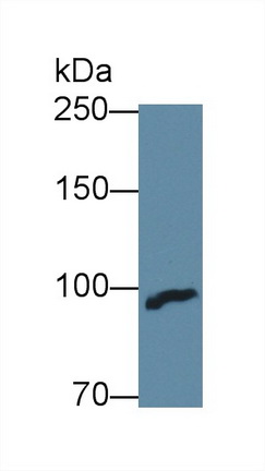 Polyclonal Antibody to Complement Factor B (CFB)