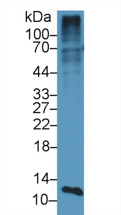 Polyclonal Antibody to S100 Calcium Binding Protein A4 (S100A4)