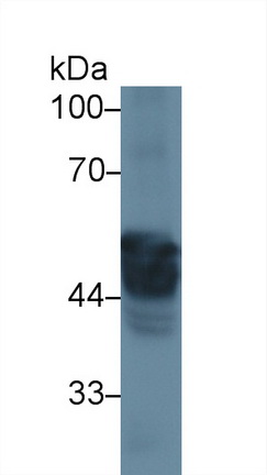 Polyclonal Antibody to Cytokeratin 8 (CK8)