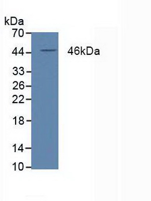 Polyclonal Antibody to Peroxisome Proliferator Activated Receptor Delta (PPARd)