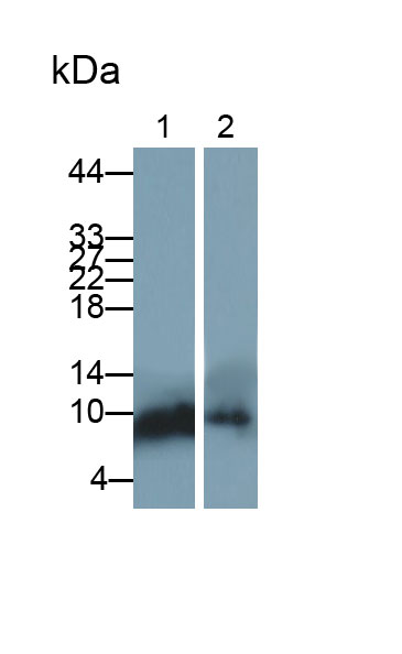 Polyclonal Antibody to S100 Calcium Binding Protein P (S100P)