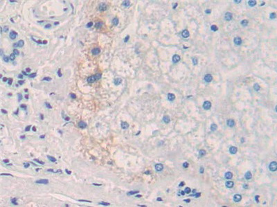 Polyclonal Antibody to Interleukin 20 (IL20)