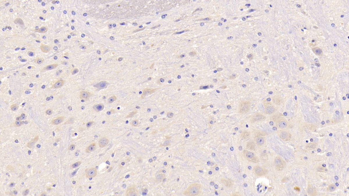 Polyclonal Antibody to Growth Differentiation Factor 6 (GDF6)