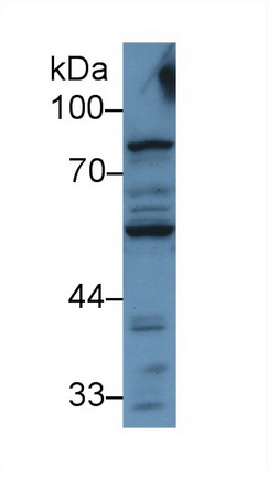 Polyclonal Antibody to Activin A Receptor Type II A (ACVR2A)