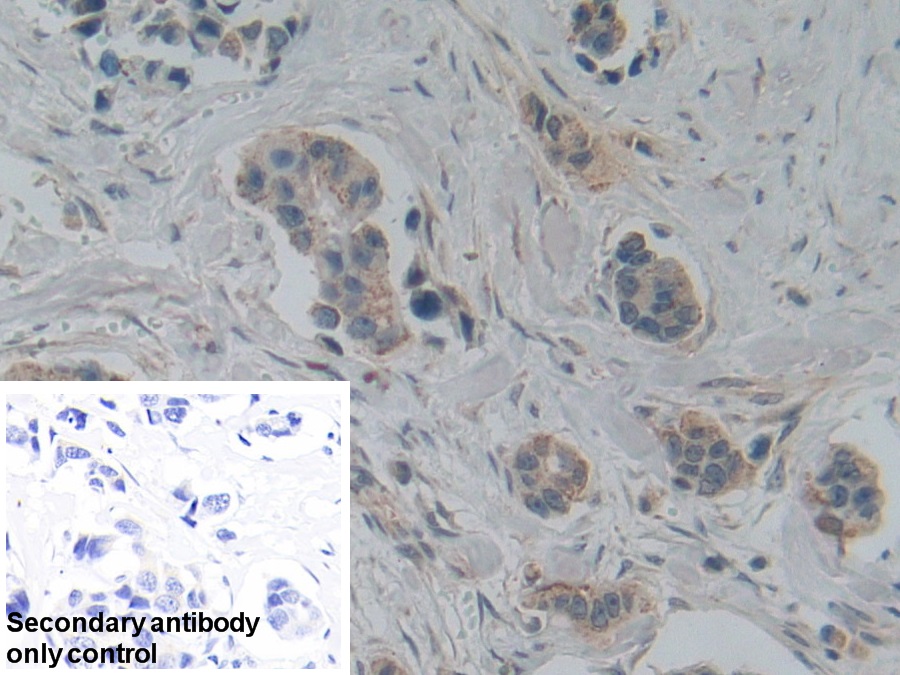 Polyclonal Antibody to SMAD family member 5 (SMAD5)