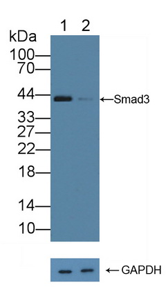 Polyclonal Antibody to SMAD family member 3 (SMAD3)