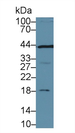 Polyclonal Antibody to SMAD family member 3 (SMAD3)