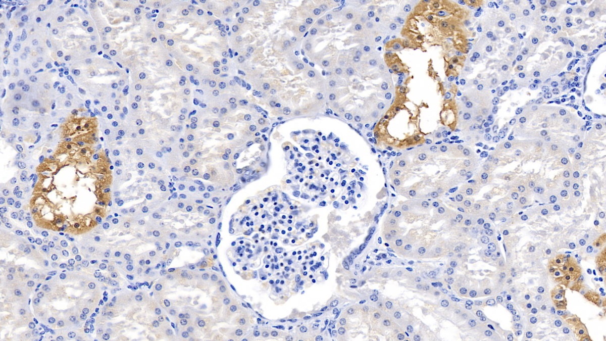 Polyclonal Antibody to Noggin (NOG)