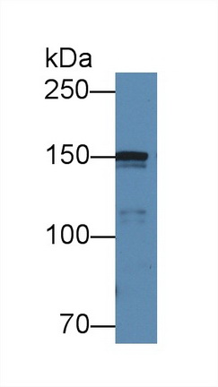 Polyclonal Antibody to Collagen Type IV Alpha 5 (COL4a5)
