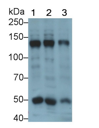 Polyclonal Antibody to Collagen Type IV Alpha 5 (COL4a5)