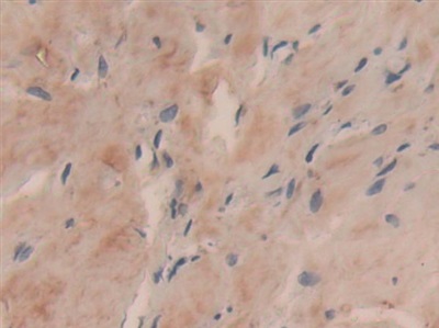 Polyclonal Antibody to Collagen Type VI Alpha 3 (COL6a3)