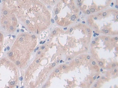 Polyclonal Antibody to Persephin (PSPN)