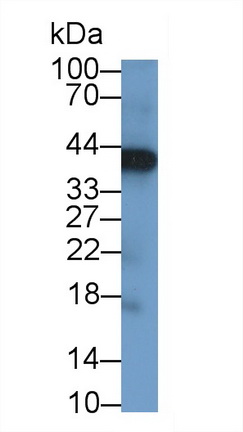 Polyclonal Antibody to Left/Right Determination Factor 1 (LEFTY1)