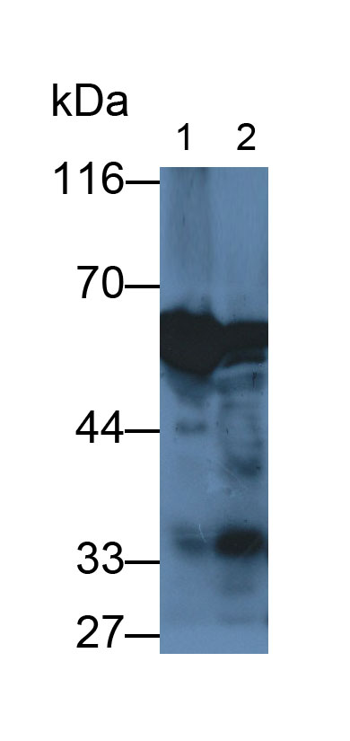 Polyclonal Antibody to Amyloid Beta Precursor Protein Binding Protein 1 (APPBP1)