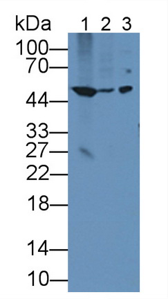 Polyclonal Antibody to Bleomycin Hydrolase (BLMH)