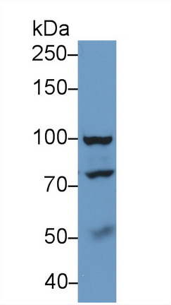 Polyclonal Antibody to Topoisomerase I (TOP1)