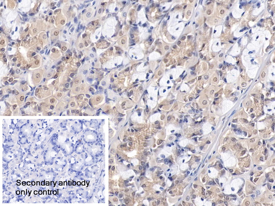 Polyclonal Antibody to Wilms Tumor 1 Associated Protein (WTAP)