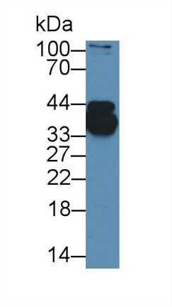 Polyclonal Antibody to Heterogeneous Nuclear Ribonucleoprotein A1 (HNRNPA1)